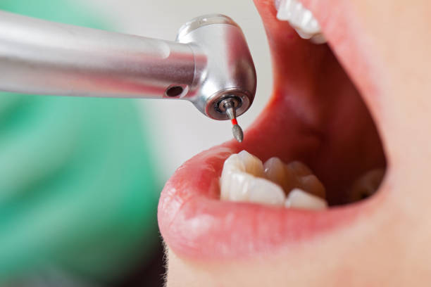 Best Emergency Broken Tooth Repair in Murrells Inlet, SC